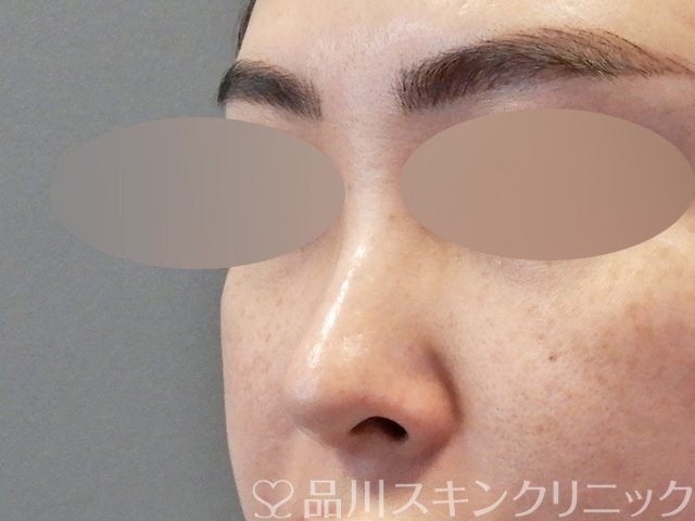症例NO.67609のBEFORE写真