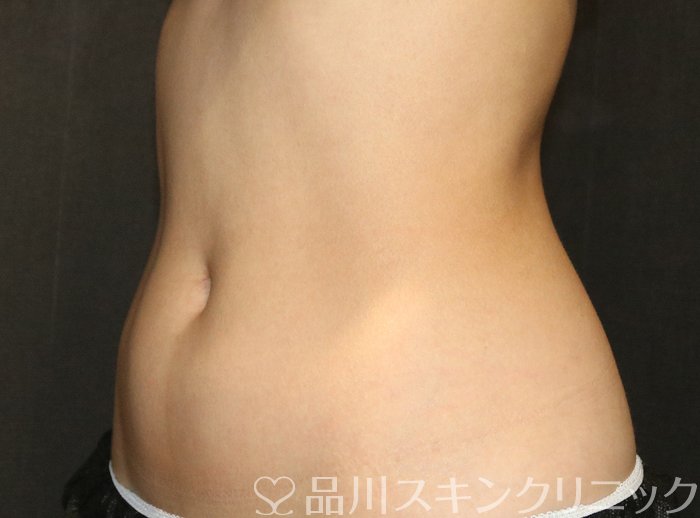 症例NO.69707のBEFORE写真