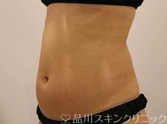 症例NO.73502のBEFORE写真