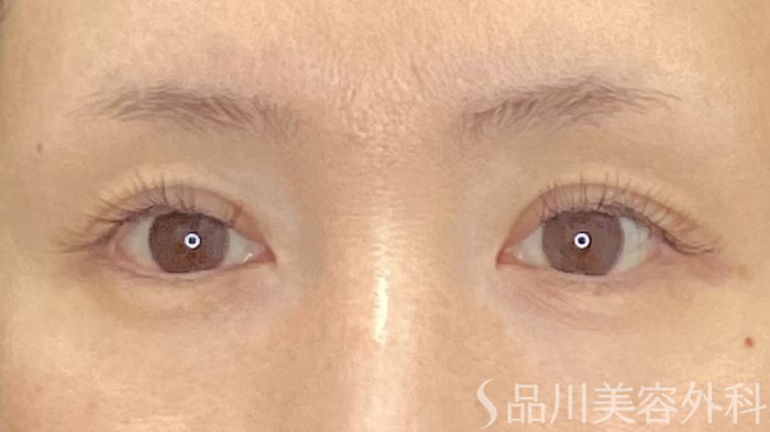 症例NO.73013のAFTER写真