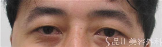 症例NO.24192のBEFORE写真