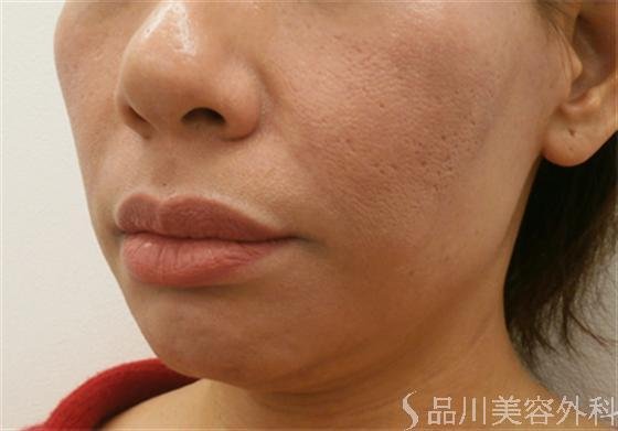 症例NO.18768のBEFORE写真