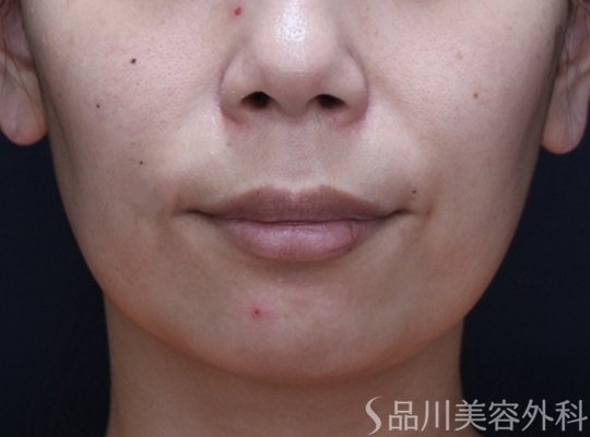 症例NO.73607のBEFORE写真