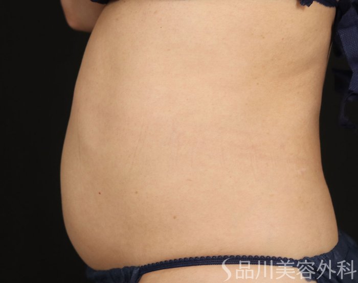 症例NO.73291のAFTER写真